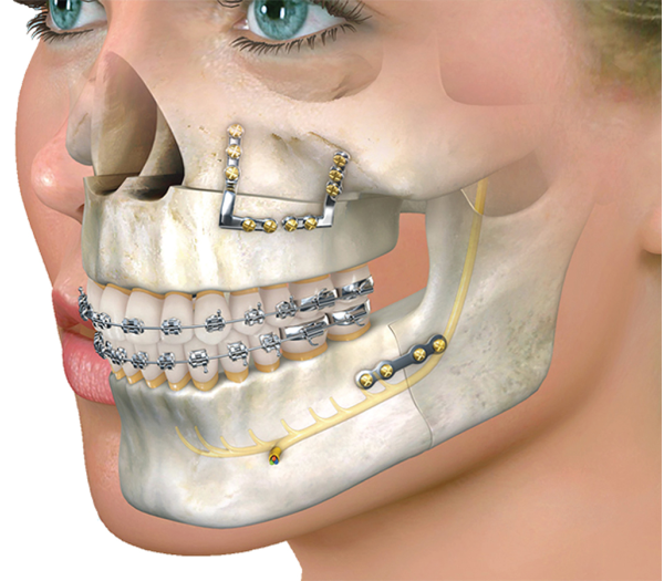 Maxillofacial_surgery