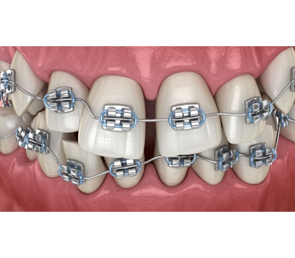 Orthodontics