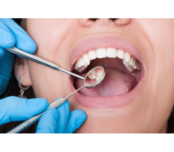 Dental Hygiene